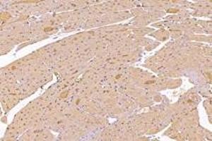Immunohistochemistry analysis of paraffin-embedded rat heart using,KIF5B (ABIN7074440) at dilution of 1: 1000