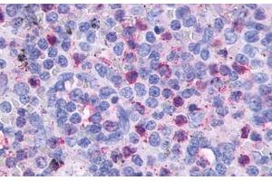 Anti-CCR2 antibody  ABIN1048389 IHC staining of human spleen. (CCR2 anticorps  (Extracellular Domain))