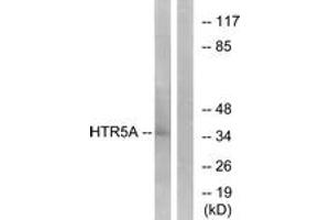 Western blot analysis of extracts from Jurkat cells, using HTR5A Antibody. (Serotonin Receptor 5A anticorps  (AA 15-64))