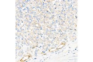 Immunohistochemistry analysis of paraffin-embedded rat stomach using Plectin Rabbit mAb at dilution of 1:1000 (40x lens). (PLEC anticorps)