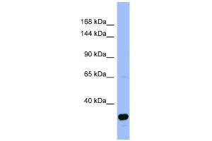 WB Suggested Anti-FANCA Antibody Titration:  0. (FANCA anticorps  (N-Term))