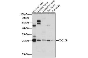 Western blot analysis of extracts of various cell lines, using COQ10B antibody. (COQ10B anticorps)