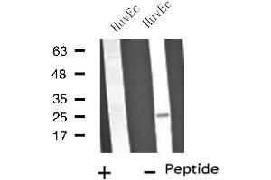 Western blot analysis of extracts from HuvEc cells, using VTI1B antibody.