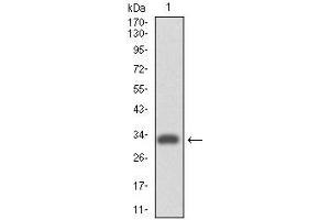 Western blot analysis using ITGA4 mAb against human ITGA4 (AA: 926-978) recombinant protein.
