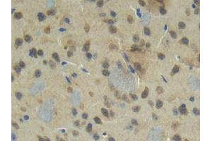 DAB staining on IHC-P; Samples: Mouse Cerebrum Tissue