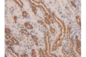 Detection of LDHB in Rat Kidney Tissue using Polyclonal Antibody to Lactate Dehydrogenase B (LDHB)