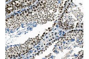 ABIN6265745 and ABIN6266869 at 1/100 staining Mouse testis tissue by IHC-P. (TRIP13 anticorps  (C-Term))