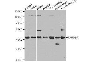 Western blot analysis of extracts of various cell lines, using TARDBP antibody. (TARDBP anticorps  (AA 1-100))