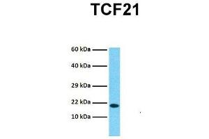 Host:  Rabbit  Target Name:  TCF21  Sample Tissue:  Human Hela  Antibody Dilution:  1.