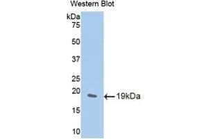 Detection of Recombinant WISP1, Mouse using Polyclonal Antibody to WNT1 Inducible Signaling Pathway Protein 1 (WISP1)