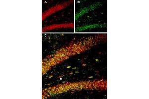 Multiplex staining of BDNF and proBDNF in rat hippocampus - Immunohistochemical staining of rat hippocampal dentate gyrus perfusion-fixed frozen sections using Guinea pig Anti-BDNF Antibody (ABIN7042969, ABIN7045379 and ABIN7045380), (1:300) and Anti-proBDNF Antibody (ABIN7043558, ABIN7044753 and ABIN7044754), (1:200). (Pro BDNF anticorps  (Pro-Domain))