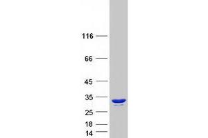 Validation with Western Blot