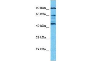 Western Blotting (WB) image for anti-KRAB-A Domain Containing 2 (KRBA2) (N-Term) antibody (ABIN2791626) (KRBA2 anticorps  (N-Term))