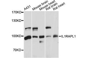 Western blot analysis of extracts of various cell lines, using IL1RAPL1 antibody (ABIN5971751) at 1:3000 dilution. (IL1RAPL1 anticorps)
