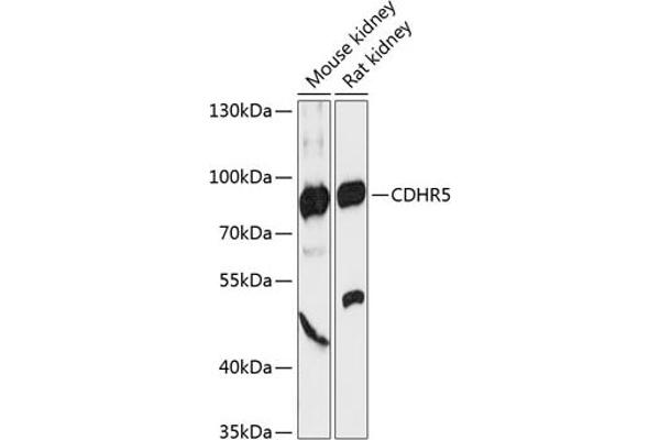 CDHR5 anticorps  (AA 26-220)