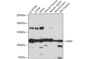 Western blot analysis of extracts of various cell lines, using GMIP antibody (ABIN7267369) at 1:1000 dilution. (GMIP anticorps  (AA 1-91))