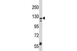 Western blot analysis of CD11c antibody and MDA-MB231 lysate.