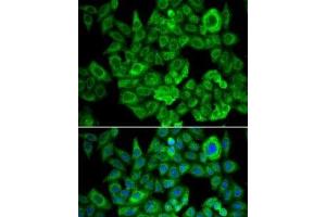 Immunofluorescence analysis of U2OS cells using OGDH Polyclonal Antibody (alpha KGDHC anticorps)