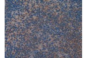 IHC-P analysis of Mouse Spleen Tissue, with DAB staining. (MEK2 anticorps  (AA 44-313))