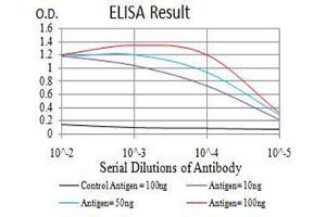 Black line: Control Antigen (100 ng),Purple line: Antigen (10 ng), Blue line: Antigen (50 ng), Red line:Antigen (100 ng)