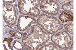 ABIN6266990 at 1/100 staining human kidney tissue sections by IHC-P. (FAP anticorps  (Internal Region))