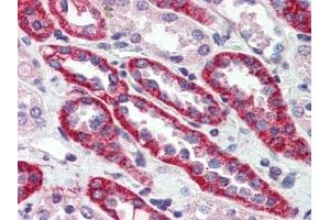 Human Kidney (formalin-fixed, paraffin-embedded) stained with CASRat 15 µg/ml followed by biotinylated goat anti-rabbit IgG secondary antibody, alkaline phosphatase-streptavidin and chromogen. (CASR anticorps  (N-Term))