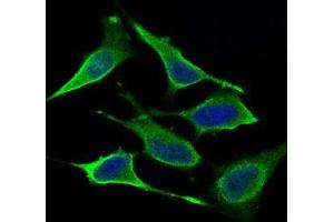 Immunofluorescence analysis of Hela cells using DNM1L mouse mAb (green). (Dynamin 1-Like anticorps  (AA 69-213))