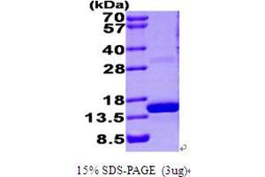 SDS-PAGE (SDS) image for S100 Calcium Binding Protein A9 (S100A9) (AA 1-114) protein (His tag) (ABIN666986)
