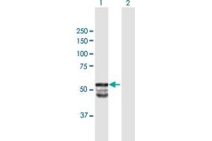 GAL3ST1 anticorps  (AA 1-423)