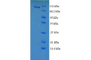 SDS-PAGE (SDS) image for Protein S (PROS) (AA 42-675) protein (GST tag) (ABIN5710155) (PROS1 Protein (AA 42-675) (GST tag))