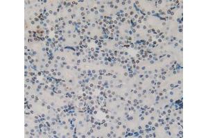 IHC-P analysis of kidney tissue, with DAB staining. (Cytokeratin 1 anticorps  (AA 489-625))