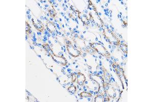 Immunohistochemistry of paraffin-embedded Mouse kidney using R Rabbit pAb (ABIN6131585, ABIN6146704, ABIN6146705 and ABIN6222716) at dilution of 1:50 (40x lens).