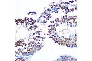 Immunohistochemistry of paraffin-embedded mouse testis using J/CSN5/COPS5 Rabbit mAb (ABIN7266497) at dilution of 1:100 (40x lens).