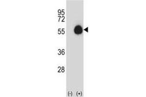 Western blot analysis of CD33 antibody and 293 cell lysate (2 ug/lane) either nontransfected (Lane 1) or transiently transfected (2) with the CD33 gene. (CD33 anticorps  (AA 88-117))