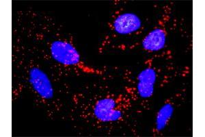 Proximity Ligation Analysis of protein-protein interactions between CCNB1 and CDKN1A.