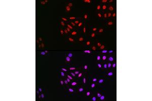 Immunofluorescence analysis of U2OS cells using Phospho-Cyclin E1-T395 Rabbit pAb (ABIN3019434, ABIN3019435, ABIN3019436 and ABIN6225368) at dilution of 1:100 (40x lens).