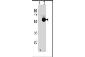 Western blot analysis of CTBP2 (arrow) using CTBP2 Antibody (N-term) Cat. (CTBP2 anticorps  (N-Term))