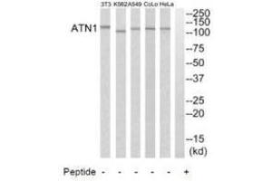 Western blot analysis of extracts from HeLa cells, A549 cells, K562 cells, COLO205 cells and NIH-3T3 cells, using ATN1 antibody. (Atrophin 1 anticorps  (N-Term))