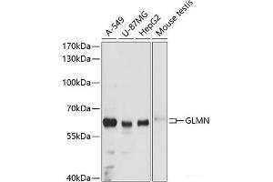 Western blot analysis of extracts of various cell lines using GLMN Polyclonal Antibody at dilution of 1:3000. (GLMN anticorps)