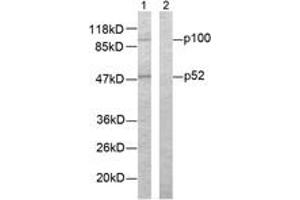 Western blot analysis of extracts from ovary cancer cells, using NF-kappaB p100/p52 (Ab-865) Antibody. (NFKB2 anticorps  (AA 833-882))