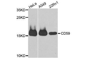 Western blot analysis of extracts of various cell lines, using CD59 antibody. (CD59 anticorps  (AA 26-128))