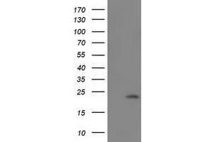 Western Blotting (WB) image for anti-Superoxide Dismutase 2, Mitochondrial (SOD2) antibody (ABIN1499530) (SOD2 anticorps)