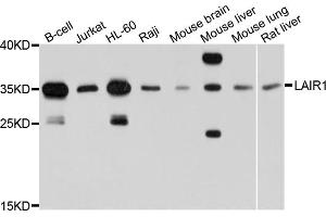Western blot analysis of extracts of various cell lines, using LAIR1 antibody (ABIN6003818) at 1/1000 dilution. (LAIR1 anticorps)
