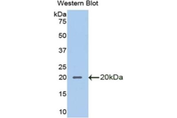 SLPI anticorps  (AA 20-131)