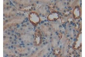 Detection of RANk in Rat Kidney Tissue using Polyclonal Antibody to Receptor Activator Of Nuclear Factor Kappa B (RANk)