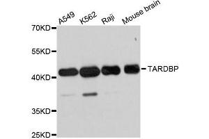 Western blot analysis of extracts of various cell lines, using TARDBP antibody. (TARDBP anticorps)
