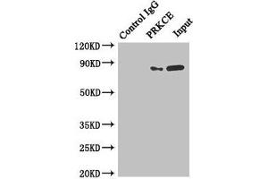 Immunoprecipitating PRKCE in MCF-7 whole cell lysate Lane 1: Rabbit control IgG instead of (1 μg) instead of ABIN7165706 in MCF-7 whole cell lysate. (PKC epsilon anticorps  (AA 488-737))