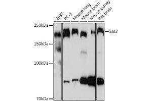 Western blot analysis of extracts of various cell lines, using Slit2 Rabbit mAb (ABIN7270335) at 1:1000 dilution.