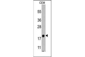 Western blot analysis of anti-PPBP Pab in CEM cell line lysates (35ug/lane). (CXCL7 anticorps  (C-Term))