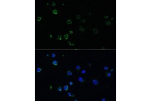 Immunofluorescence analysis of Jurkat cells using PM antibody (ABIN6134400, ABIN6145810, ABIN6145811 and ABIN6225100) at dilution of 1:100. (NOXA anticorps  (AA 1-54))